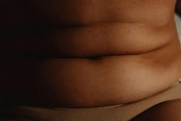 The Hidden Connection: How Stress Shapes Your Fitness and Body Composition 3 image of what stress can do on the stomach area and how Lipo 360 Ashford can help to change your body shape.